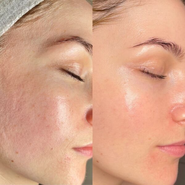 Avant/Après Masque Éclat Riz & Miel Beauty of Joseon — résultats visibles en 7 jours