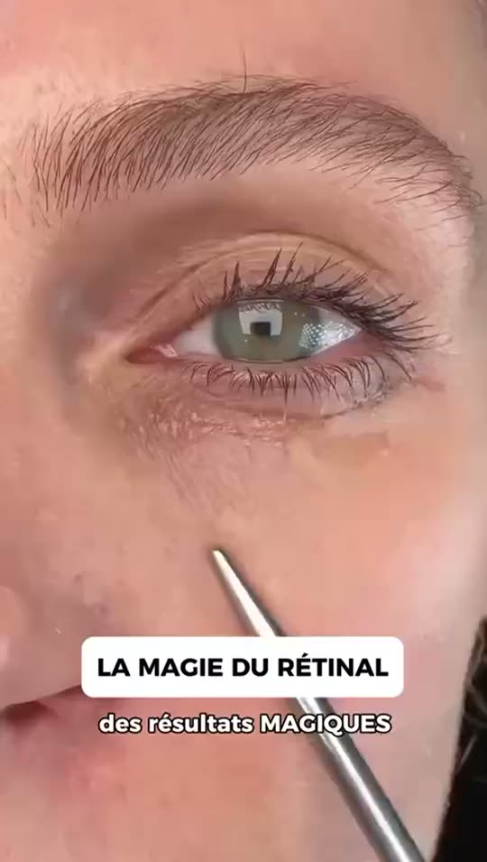 Témoignage cliente LuméaSkin